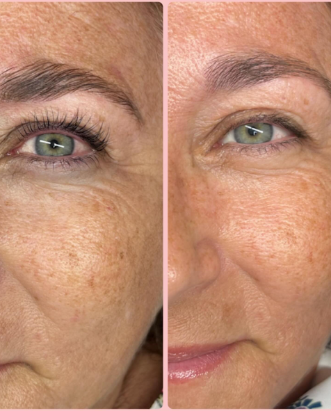 susy-eyes-estetica-de-cejas-y-pestanas-0